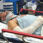 Adrián LeBarón sufrió una caída de dos metros, fracturando su brazo y golpeándose la cabeza. Fue trasladado a un hospital en El Paso, Texas.