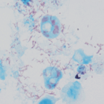 Investigadores chihuahuenses desarrollan prototipo de vacuna contra la rickettsiosis, una enfermedad transmitida por garrapatas que ha cobrado vidas en el estado.